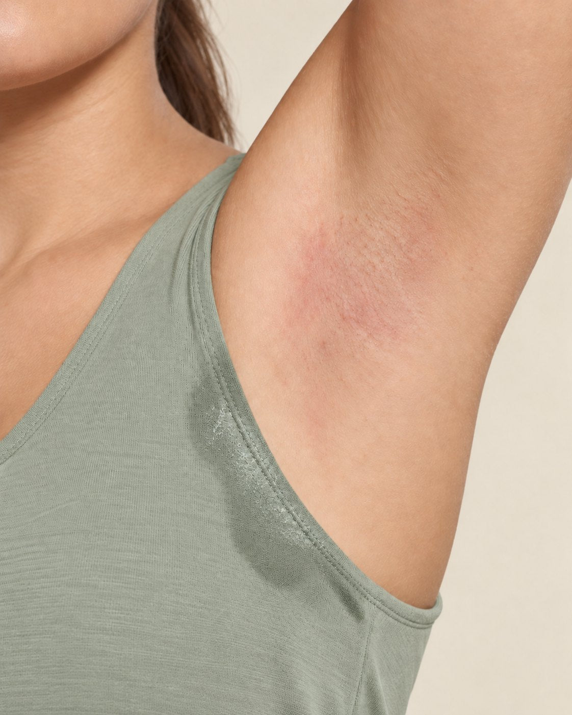 Sans soin : peau irritée et trace sur le t-shirt